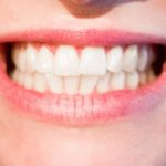 Dzisiejsza technologia wykorzystywana w salonach stomatologii estetycznej zdoła sprawić, że odzyskamy śliczny uśmiech.